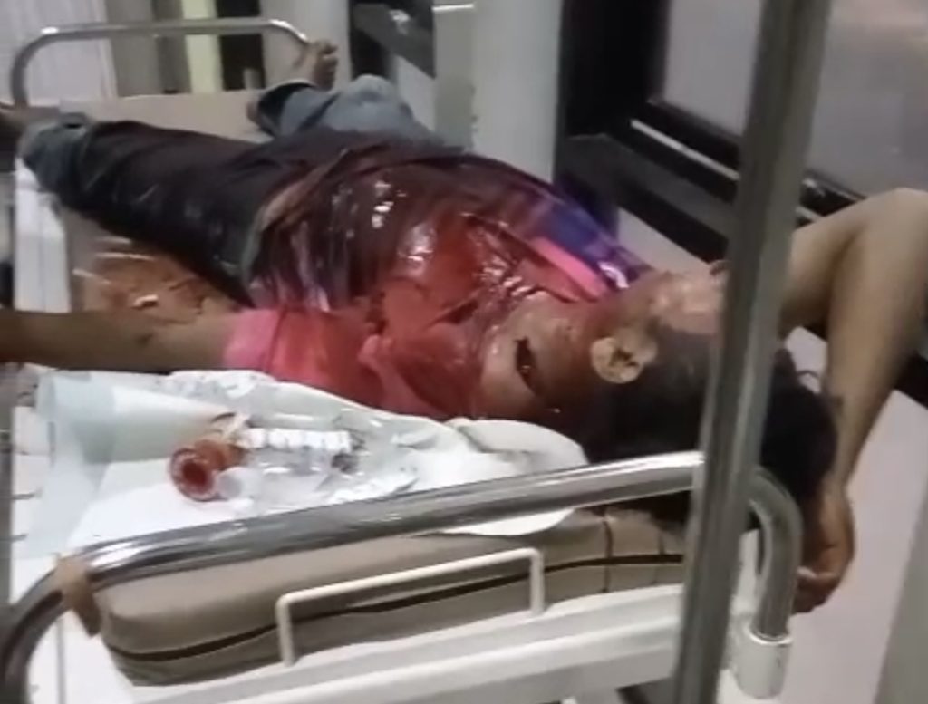 Sadis! Pria di Camplong, Sampang Diserang Clurit, Luka Parah di Kepala dan Lengan