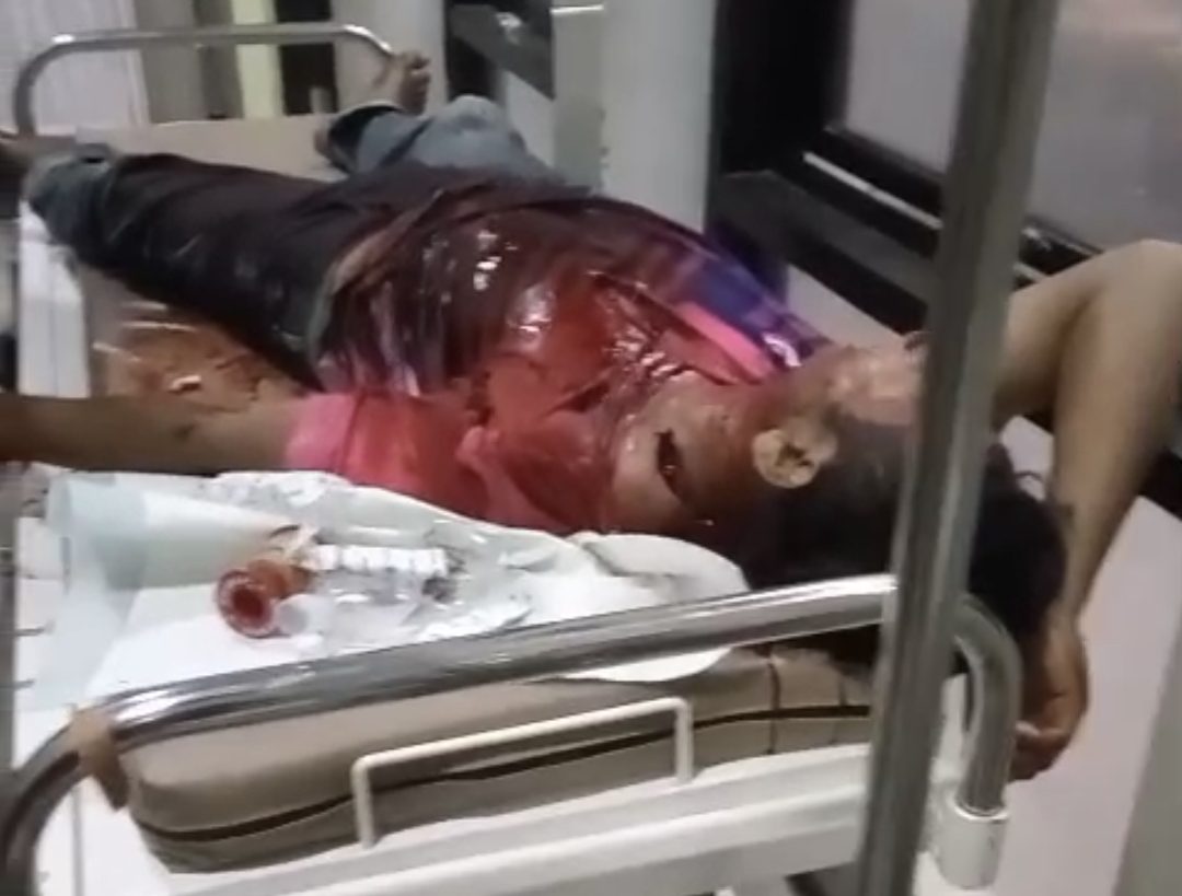 Sadis! Pria di Camplong, Sampang Diserang Clurit, Luka Parah di Kepala dan Lengan