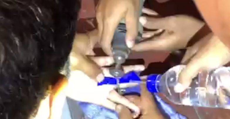 Siswi SMPN yang Jarinya Terjepit Engsel Jendela Berhasil Dievakuasi Damkar Kota Mojokerto